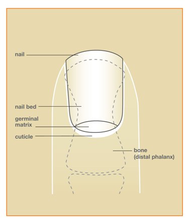 Finger And Hand Injury Injury To Nails Orthopedic Surgeons Western Finger And Hand Injury Injury To Nails Orthopedic Surgeons Western
