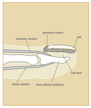 Finger And Hand Injury Injury To Nails Orthopedic Surgeons Western Finger And Hand Injury Injury To Nails Orthopedic Surgeons Western